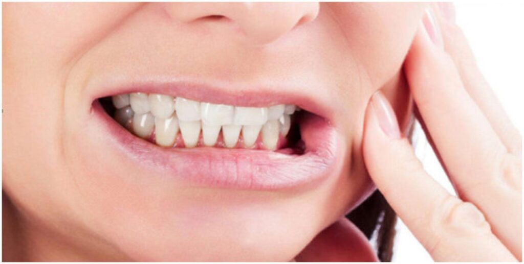 Se você tem o hábito de ranger os dentes, você pode desenvolver dentes sensíveis!